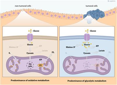 Metabolic Reprogramming in Thyroid Carcinoma